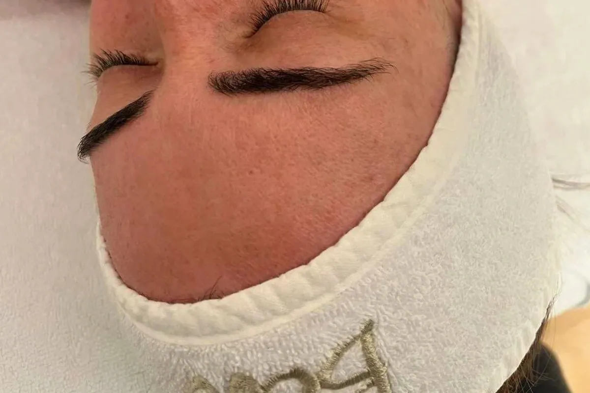Mujer recibiendo un tratamiento facial con el cabezal Axion y luz roja en la mejilla