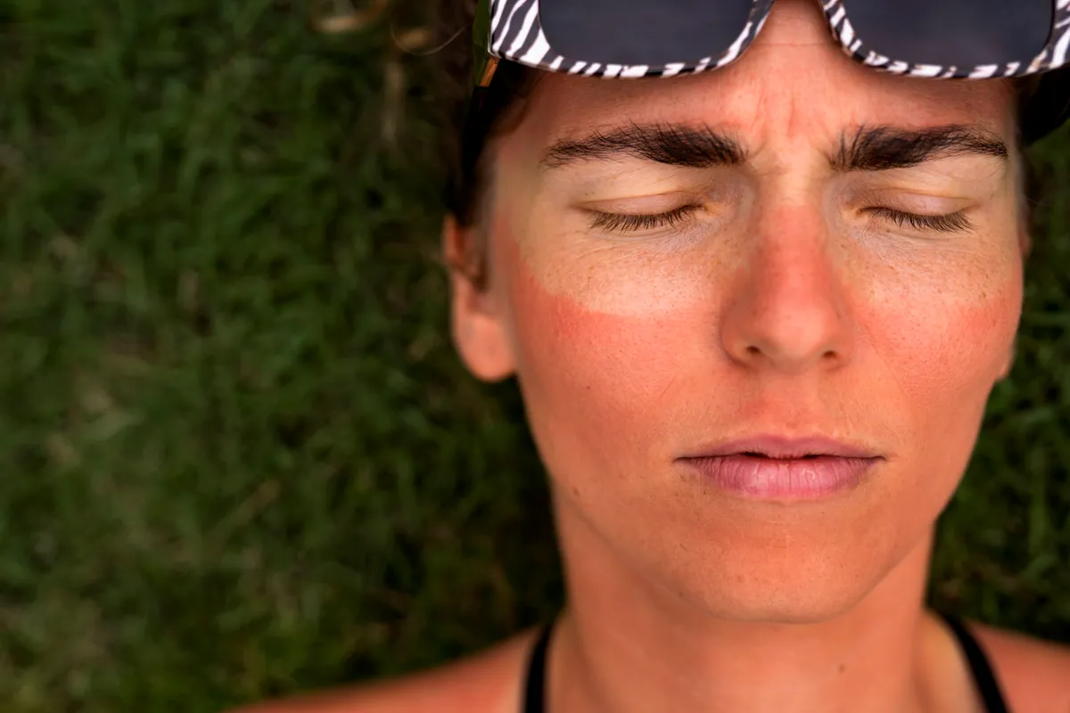 Rostro de mujer con la piel marcada por el sol