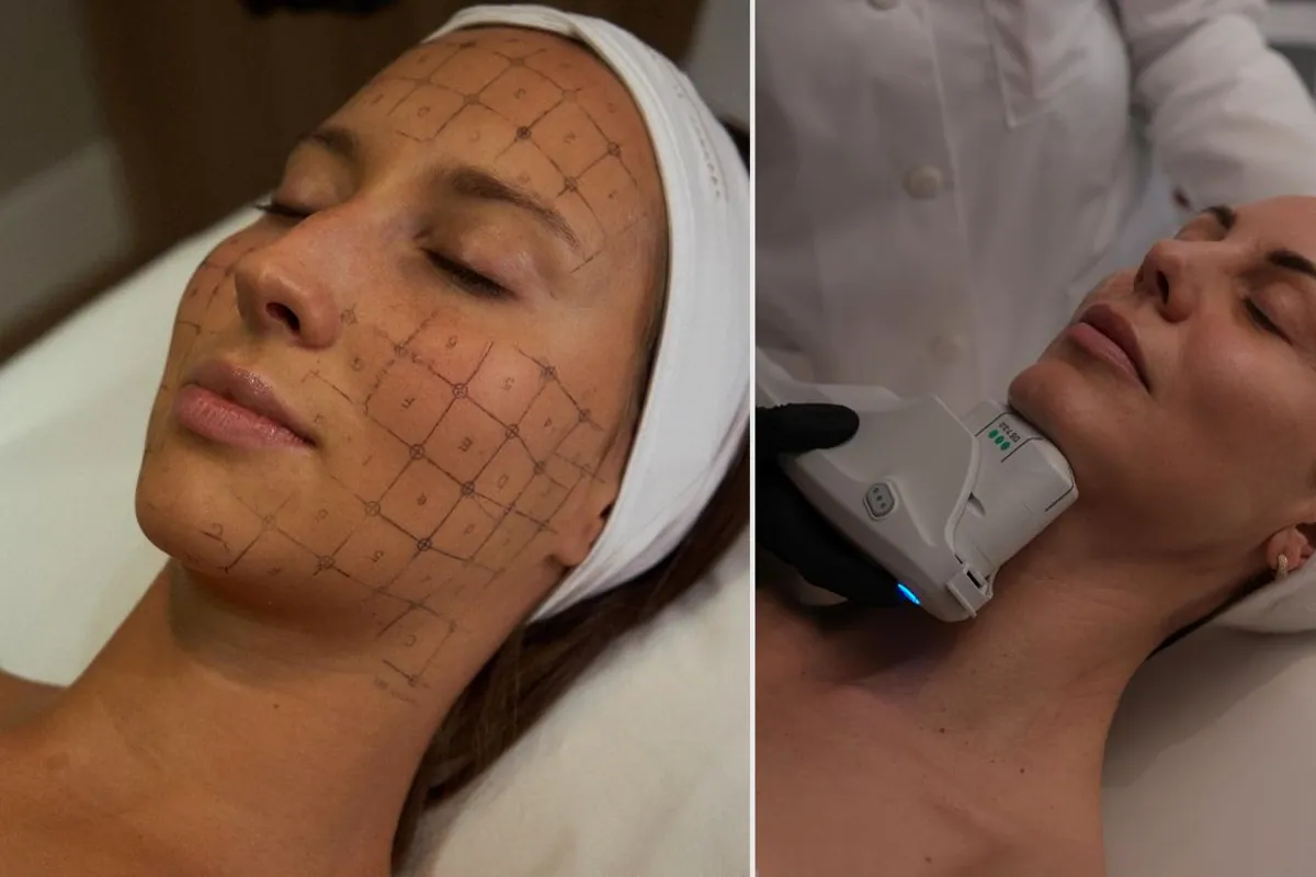 Mujer con la cara marcada para el tratamiento y aplicación del cabezal en el cuello